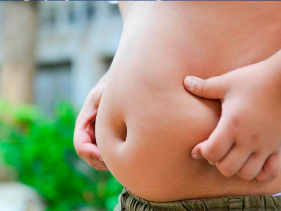 Afecta obesidad a niños tabasqueños menores de 12 años